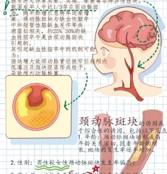 体检发现颈动脉斑块，会得脑梗死吗？