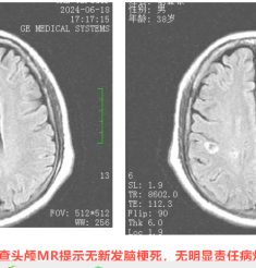 壮年男子反复出现肢体无力，中西医结合治疗后痊愈