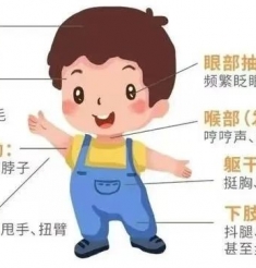 中医治疗小儿抽动有“奇效”，或可根治