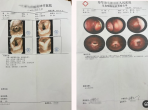 花季少女“失语”之谜，毕中医脑病科拨云见日愈疾