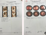花季少女“失语”之谜，毕中医脑病科拨云见日愈疾