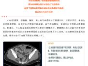 【强名技 促发展】毕节首次独立完成：POEM术重启“生命通道”，10年吞咽痛苦终得解